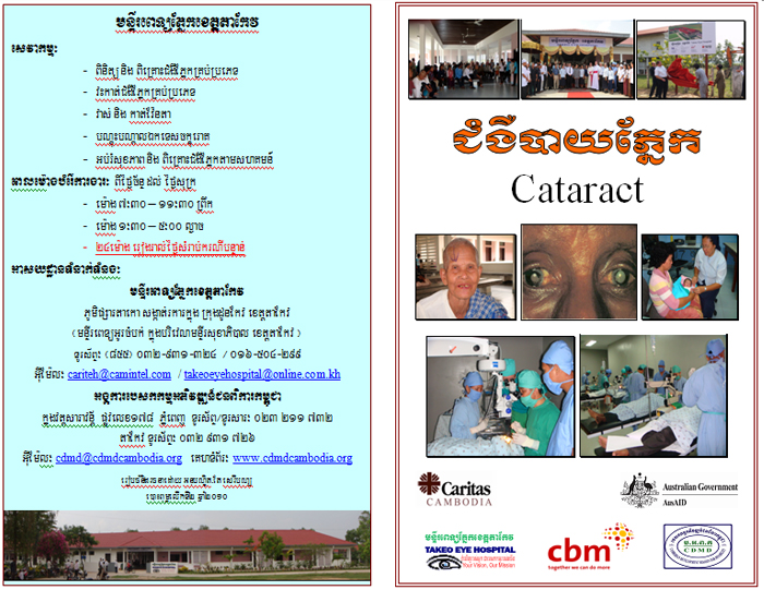 Cataract poster