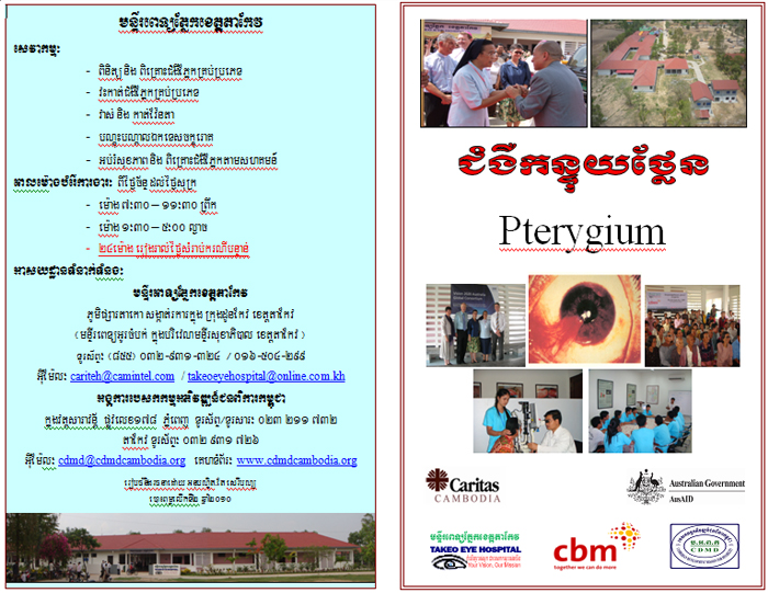 Pterygium poster